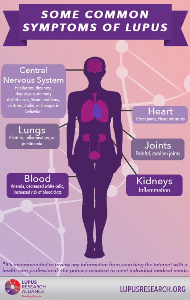 Lupus-Symptoms-infographic - Lupus Research